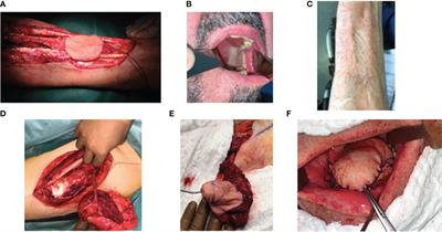 Reconstructive flap surgery in head and neck cancer patients: an interdisciplinary view of the challenges encountered by radiation oncologists in postoperative radiotherapy